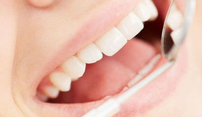 Professionelle Zahnreinigung – Zahnarzt Yves Anke